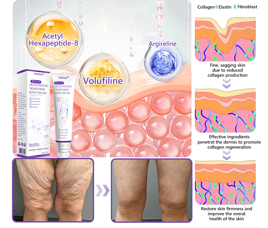 💎Vitalisys® PDRN Multi-Peptide Massaging Body Roller Cream- Anti-aging, Hydrating, Skin Firming & Lifting, Skin Repair, Even Tone, Acne and Dark Spot Treatment, Wart and Mole Removal, and Psoriasis Relief.