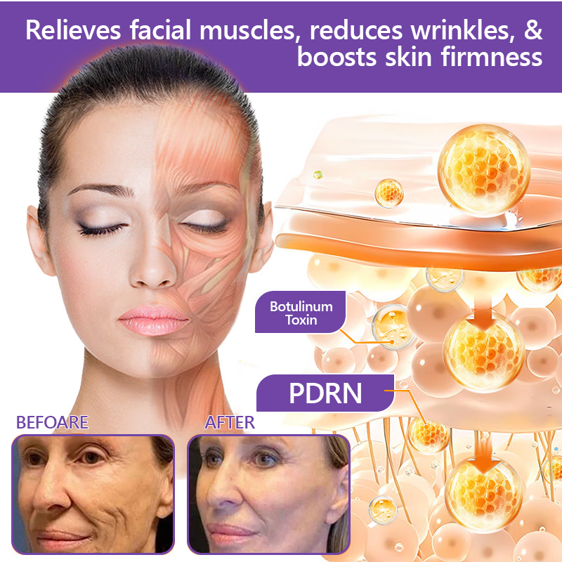 💎Vitalisys® PDRN Multi-Peptide Massaging Body Roller Cream- Anti-aging, Hydrating, Skin Firming & Lifting, Skin Repair, Even Tone, Acne and Dark Spot Treatment, Wart and Mole Removal, and Psoriasis Relief.