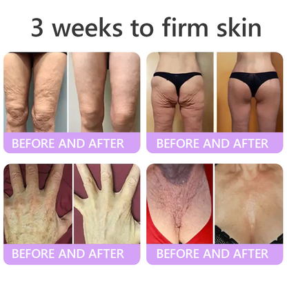 30%OFF 🥇🥇 𝐕𝐢𝐭𝐚𝐥𝐢𝐬𝐲𝐬® 𝐏𝐃𝐑𝐍 𝐌𝐮𝐥𝐭𝐢-𝐏𝐞𝐩𝐭𝐢𝐝𝐞 𝐌𝐚𝐬𝐬𝐚𝐠𝐢𝐧𝐠 𝐁𝐨𝐝𝐲 𝐑𝐨𝐥𝐥𝐞𝐫 𝐂𝐫𝐞𝐚𝐦- Anti-aging, Hydrating, Skin Firming & Lifting, Skin Repair, Even Tone, Acne and Dark Spot Treatment, Wart and Mole Removal, and Psoriasis Relief.