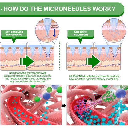 𝐀𝐮𝐬𝐬𝐢𝐞 𝐃𝐨𝐜𝐭𝐨𝐫 𝐑𝐞𝐜𝐨𝐦𝐦𝐞𝐧𝐝𝐞𝐝 👨‍⚕️ |🌈🌈 𝑴𝑼𝑹𝑾𝑶𝑵® 𝗕𝗲𝗿𝗯𝗲𝗿𝗶𝗻𝗲 𝟏𝟎-𝐢𝐧-𝟏 𝗡𝗮𝗻𝗼 𝗠𝗶𝗰𝗿𝗼𝗻𝗲𝗲𝗱𝗹𝗲 𝗣𝗮𝘁𝗰𝗵 | 𝐴𝑑𝑣𝑎𝑛𝑐𝑒𝑑 10-𝑖𝑛-1 𝑓𝑜𝑟𝑚𝑢𝑙𝑎 | ✅ 𝑉𝑖𝑠𝑖𝑏𝑙𝑒 𝑟𝑒𝑠𝑢𝑙𝑡𝑠 𝑖𝑛 𝑎𝑠 𝑙𝑖𝑡𝑡𝑙𝑒 𝑎𝑠 7 𝑑𝑎𝑦𝑠 🏮