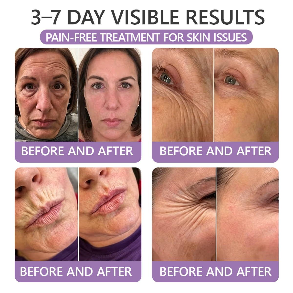 30%OFF 🥇🥇 𝐕𝐢𝐭𝐚𝐥𝐢𝐬𝐲𝐬® 𝐏𝐃𝐑𝐍 𝐌𝐮𝐥𝐭𝐢-𝐏𝐞𝐩𝐭𝐢𝐝𝐞 𝐌𝐚𝐬𝐬𝐚𝐠𝐢𝐧𝐠 𝐁𝐨𝐝𝐲 𝐑𝐨𝐥𝐥𝐞𝐫 𝐂𝐫𝐞𝐚𝐦- Anti-aging, Hydrating, Skin Firming & Lifting, Skin Repair, Even Tone, Acne and Dark Spot Treatment, Wart and Mole Removal, and Psoriasis Relief.