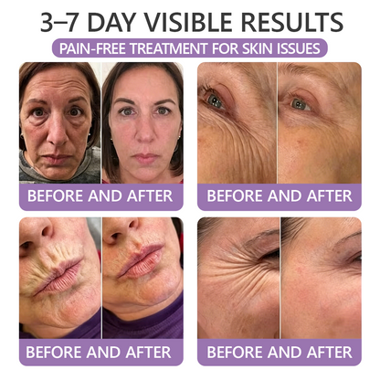 30%OFF 🥇🥇 𝐕𝐢𝐭𝐚𝐥𝐢𝐬𝐲𝐬® 𝐏𝐃𝐑𝐍 𝐌𝐮𝐥𝐭𝐢-𝐏𝐞𝐩𝐭𝐢𝐝𝐞 𝐌𝐚𝐬𝐬𝐚𝐠𝐢𝐧𝐠 𝐁𝐨𝐝𝐲 𝐑𝐨𝐥𝐥𝐞𝐫 𝐂𝐫𝐞𝐚𝐦- Anti-aging, Hydrating, Skin Firming & Lifting, Skin Repair, Even Tone, Acne and Dark Spot Treatment, Wart and Mole Removal, and Psoriasis Relief.