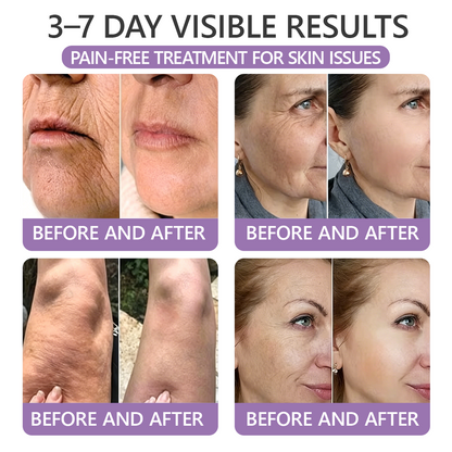 30%OFF 🥇🥇 𝐕𝐢𝐭𝐚𝐥𝐢𝐬𝐲𝐬® 𝐏𝐃𝐑𝐍 𝐌𝐮𝐥𝐭𝐢-𝐏𝐞𝐩𝐭𝐢𝐝𝐞 𝐌𝐚𝐬𝐬𝐚𝐠𝐢𝐧𝐠 𝐁𝐨𝐝𝐲 𝐑𝐨𝐥𝐥𝐞𝐫 𝐂𝐫𝐞𝐚𝐦- Anti-aging, Hydrating, Skin Firming & Lifting, Skin Repair, Even Tone, Acne and Dark Spot Treatment, Wart and Mole Removal, and Psoriasis Relief.